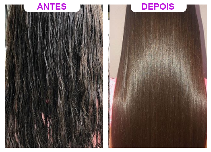 antes-deois-hidraliso