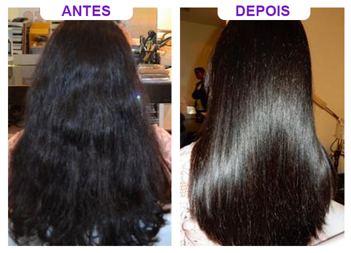 deoimento-2-antes-depois